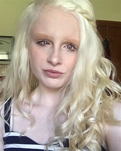 Albino Woman Becomes Tiktok Star Thanks To Violet Colored Eyes Users