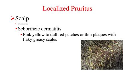 Localized Pruritus Scalp Psoriasis Ppt Download