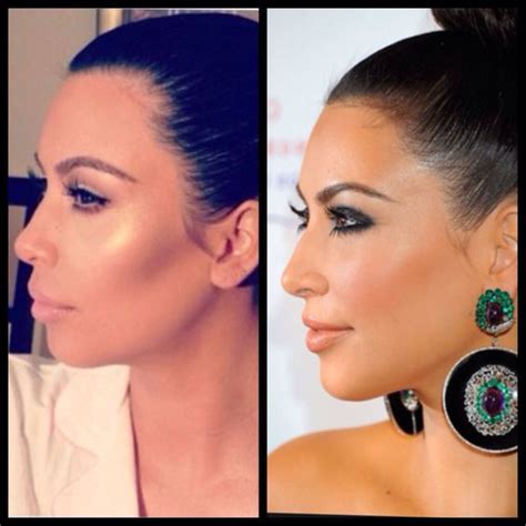 Kim Kardashian Plastic Surgery Before And After Nose Job Botox And