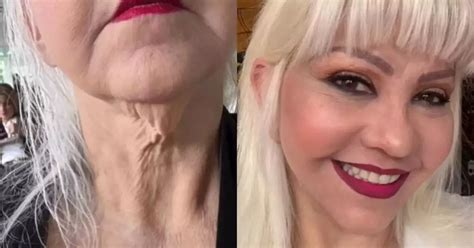 Video La Gorda Fabiola mostró el antes y el después tras cirugía