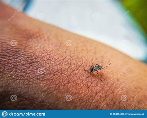 Little Mosquito Bitting Human`s Skin Stock Photo Image Of Closeup