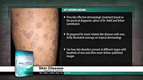 Skin Disease Diagnosis And Treatment 3rd Edition Youtube