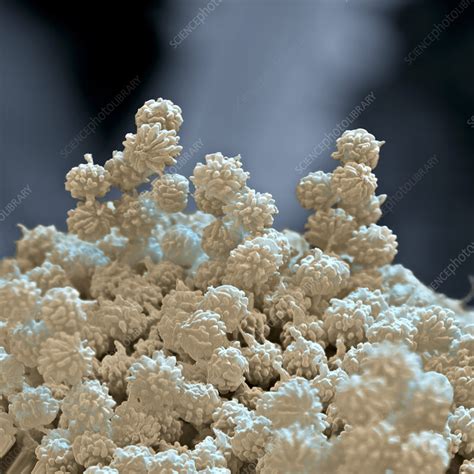 Aspergillus Niger Fungus Spores Sem Stock Image B2501768