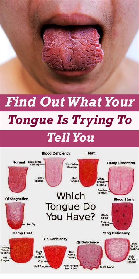Normal Tongue Color Picture