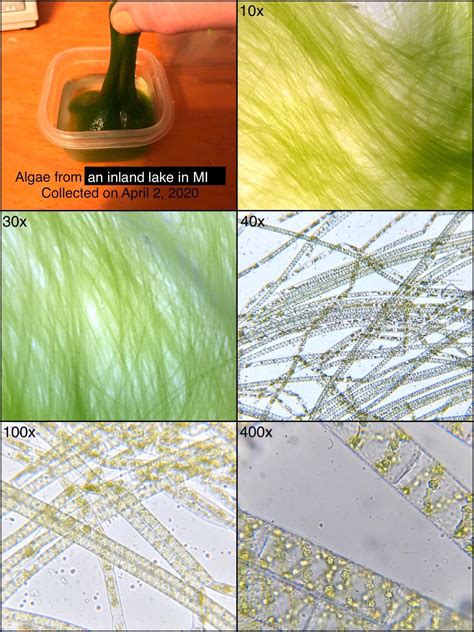 Filamentous Algae Microscope