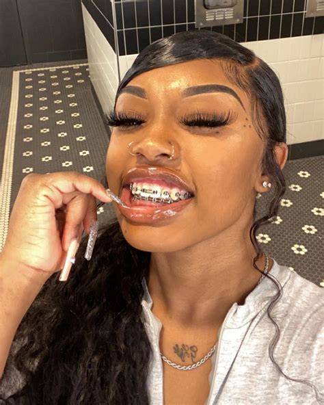 Best Braces Colors For Brown Skin Drucilla Peachey