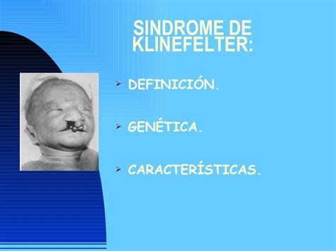 Características Da Síndrome De Klinefelter