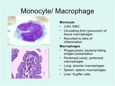 Image Result For Monocyte Macrophage Cavities Inflammation Presentation