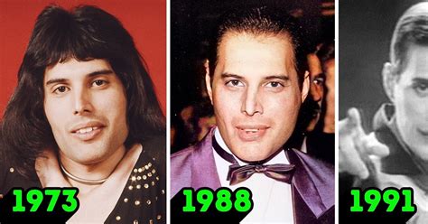 Kisah Freddie Mercury Yang Diledek Karena Giginya Dan Bagaimana Dia