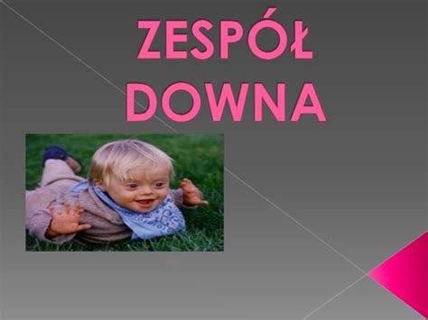 Zespół Downa Zespol Downa Trisomia 21 Przyczyny Objawy Zespół Downa To Zestaw