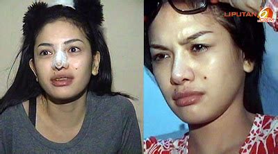 Ini Dia Tampang Nikita Mirzani Sebelum Dan Sesudah Operasi Hidung CARA