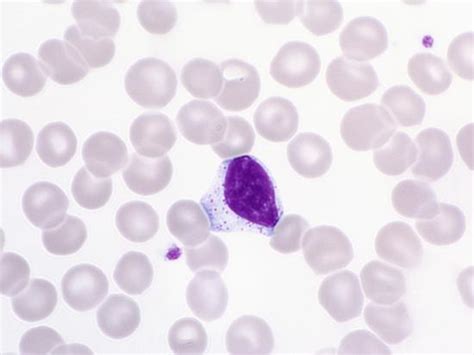Normal Human Lymphocyte White Blood Cell With Red Blood Cells And