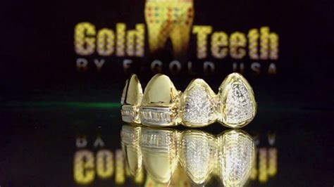 We did not find results for: Yellow Gold Teeth with Diamonds Grillz - YouTube