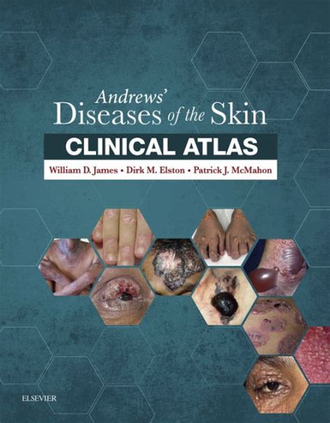 Andrews Diseases Of The Skin Clinical Atlas By William D James Md