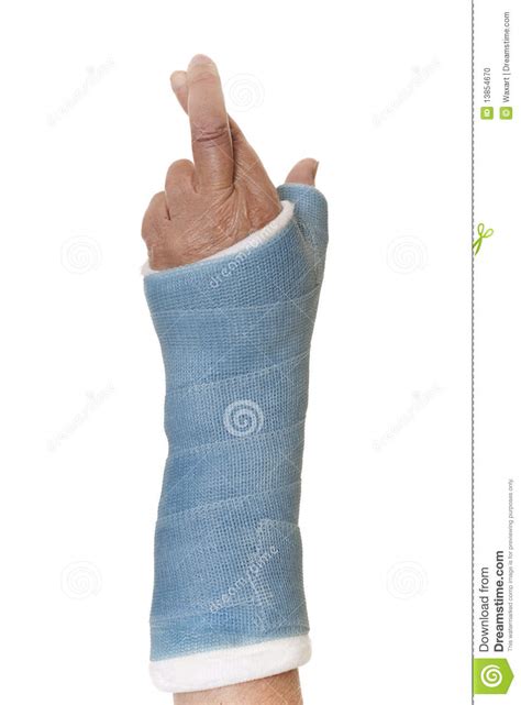 Hand And Arm In Cast With Fingers Crossed Stock Photo