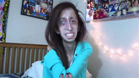 Pictures Of Lizzie Velasquez