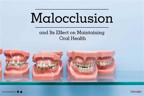 malocclusion and its effect on maintaining oral health by dr nishi tandon lybrate