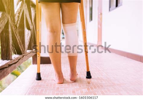 Woman Using Crutches Broken Legs Walking Stock Photo 1601506117