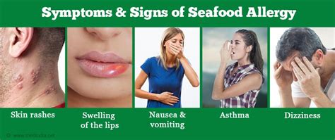 Seafood Allergies Symptoms Diagnosis And Treatment