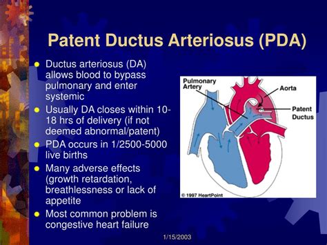 Ppt Patent Ductus Arteriosus Occlusion Device Oral Presentation My