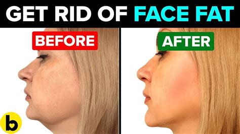 7 Easy Ways To Get A Slimmer Face In 30 Days Youtube