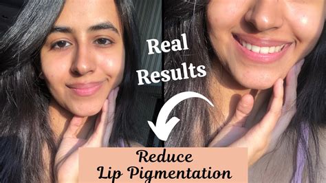 How To Get Rid Of Lip Pigmentation Real Results Youtube