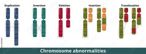 Vecteur Stock Chromosome Abnormalities Visualization Of Common