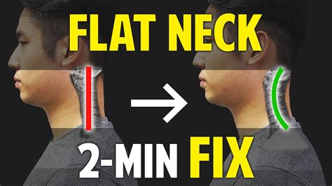 Fix Flat Neckcervical Kyphosis｜neck Correction｜balancing Exercises