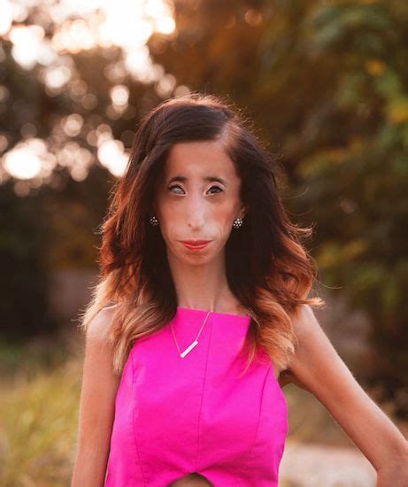Lizzie Velasquezs Response To ‘worlds Ugliest Woman Video The Mighty