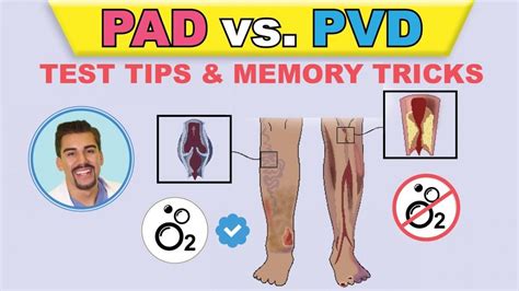 PAD Vs PVD NCLEX Review For Peripheral Vascular Conditions
