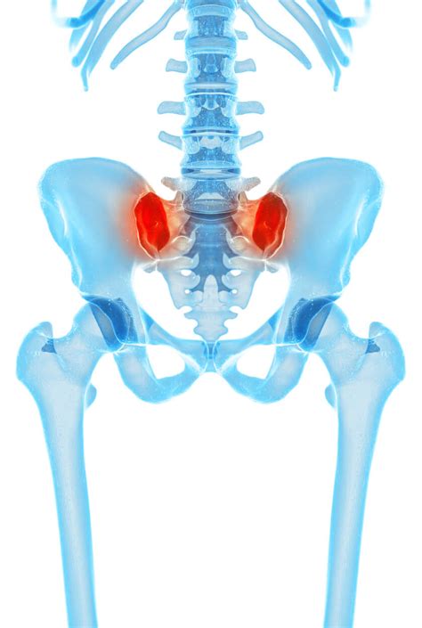 Hip And Sacroiliac Joint Pain