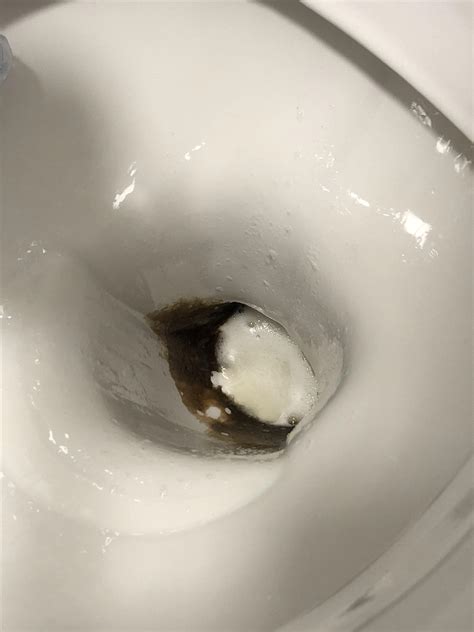 Moved Into A New Flat How Do I Clean This Dirty Toilet R CleaningTips