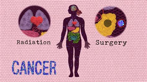 Ia merupakan masalah kesihatan yang mengungguli carta statistik kekerapan kanser di malaysia bagi wanita. Tanda Awal Kanser Yang Wajib Anda Tahu - DIET DIET SIHAT