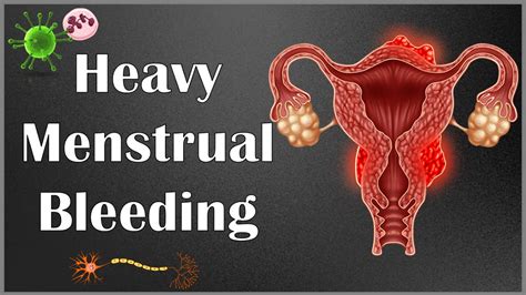 What Causes Heavy Menstrual Bleeding Menorrhagia Causes Of Heavy