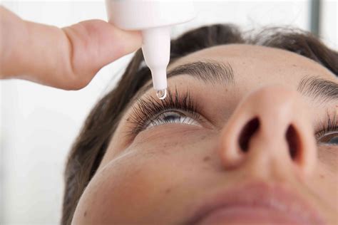 Problemas oculares causados por la psoriasis Medicina Básica