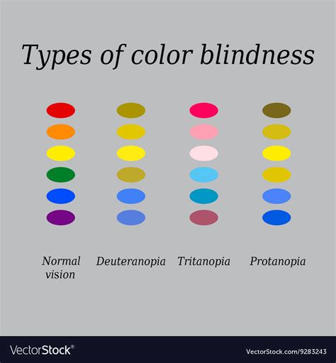 Types Of Color Blindness Eye Perception Royalty Free Vector