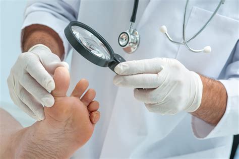 Diabetes And Feet Diagnosis Apollo Sugar Clinics