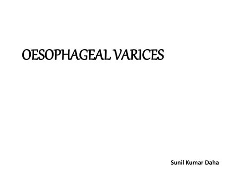 Varices Management Guide Ppt