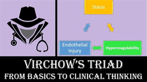 Virchows Triad From Basics To Clinical Youtube