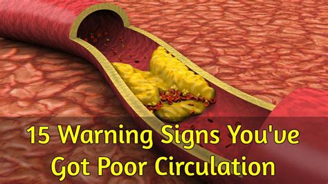 15 Warning Signs Youve Got Poor Circulation