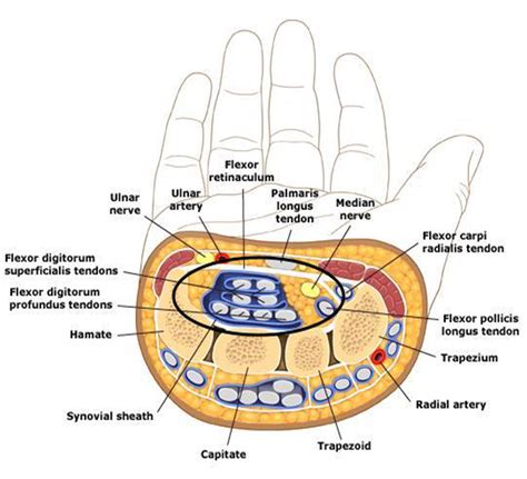 Carpal Tunnel Open Release Archives Orthopedics Notes