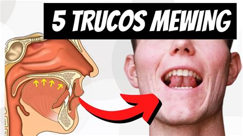 5 Trucos Para Colocar La Lengua En El Paladar Mewing Youtube