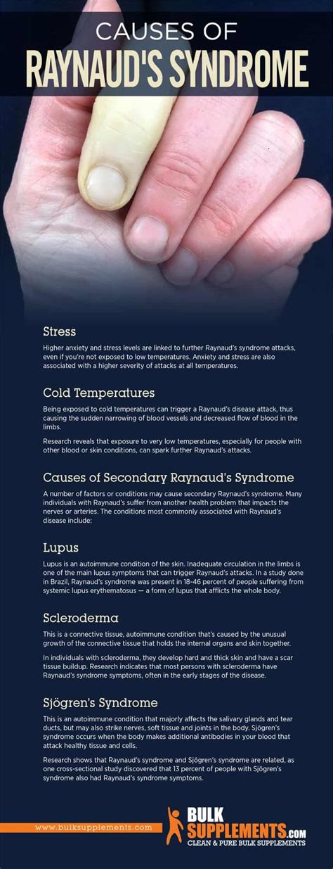 Raynauds Syndrome Symptoms Causes And Treatment By James Denlinger