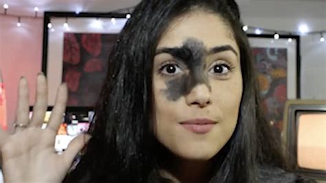 Watch Video This Woman Has A Unique Facial Birthmark Metro Video