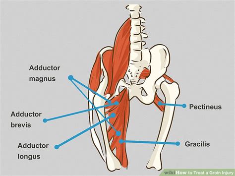 How To Treat A Groin Injury With Pictures Wikihow Fitness