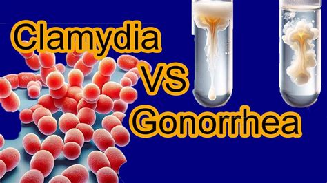 Chlamydia Vs Gonorrhea Key Differences Explained Youtube