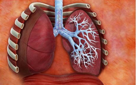 Endobronchial Valve Therapy A Nonsurgical Option For Advanced