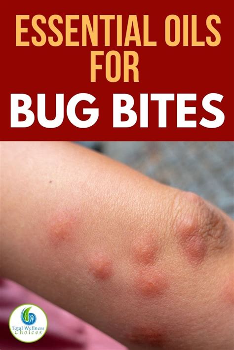 Top 7 Essential Oils For Bug Bites Essential Oils For Mosquitoes Best Essential Oils