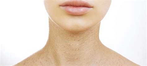 What Causes Skin Discoloration On Neck And Chest Know Here