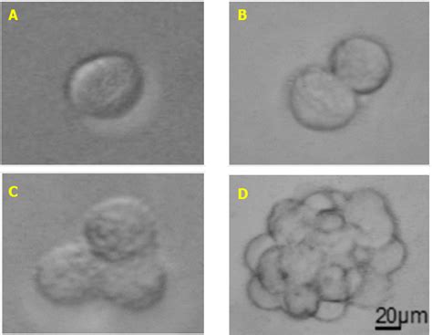 Melanoma Stem Cell Sphere Formation Assay —bio Protocol